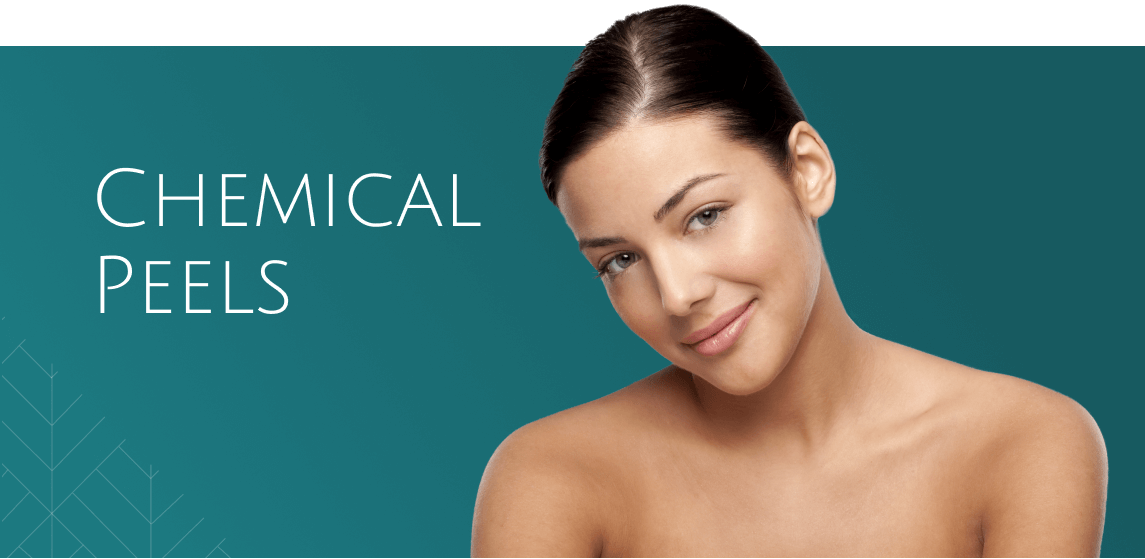 Chemical peels