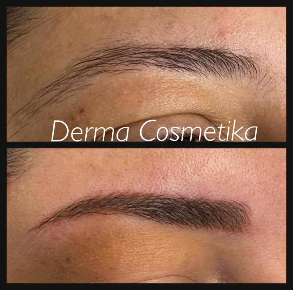 Cosmetic tattoo before after