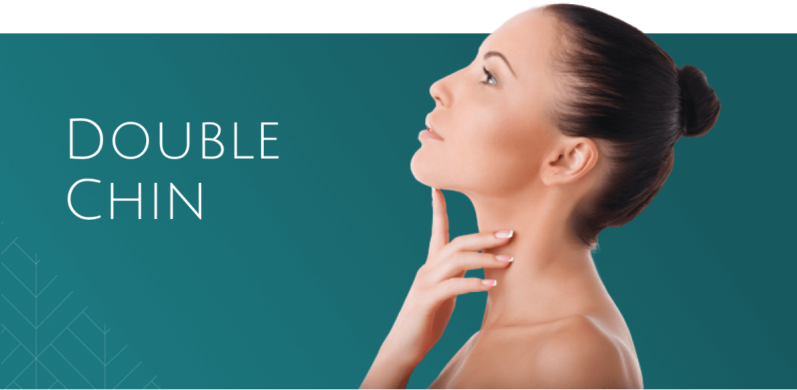 Double chin