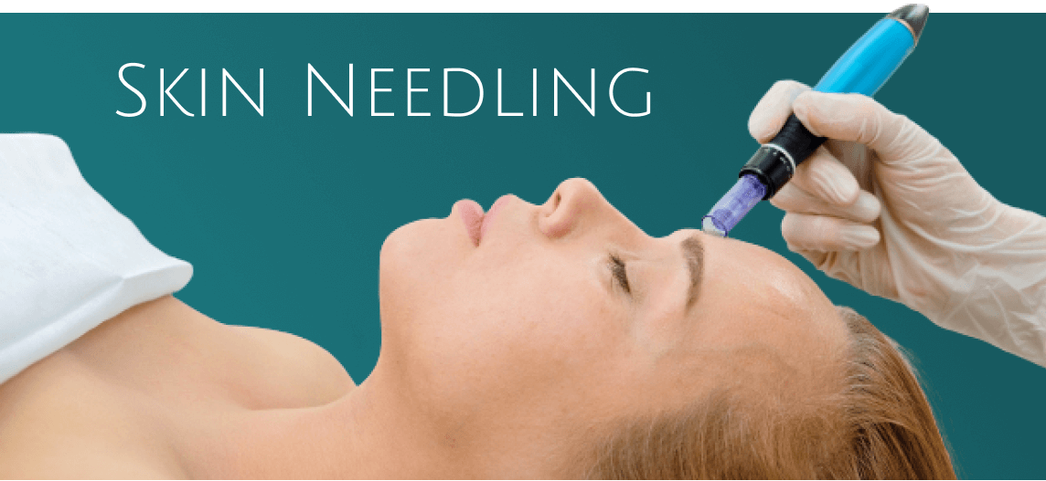 Skin needling