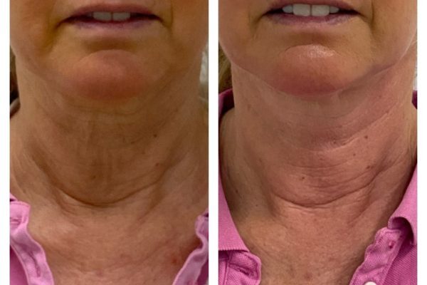 thumbnail_image_6483441