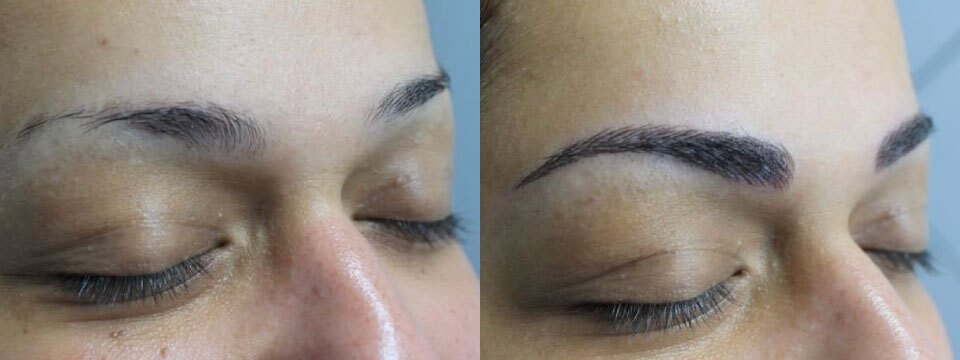cosmetic tattoo