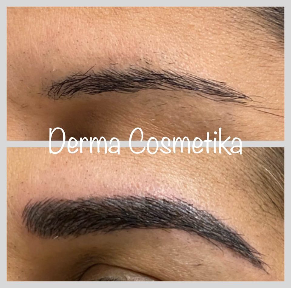 Cosmetic tattoo before after