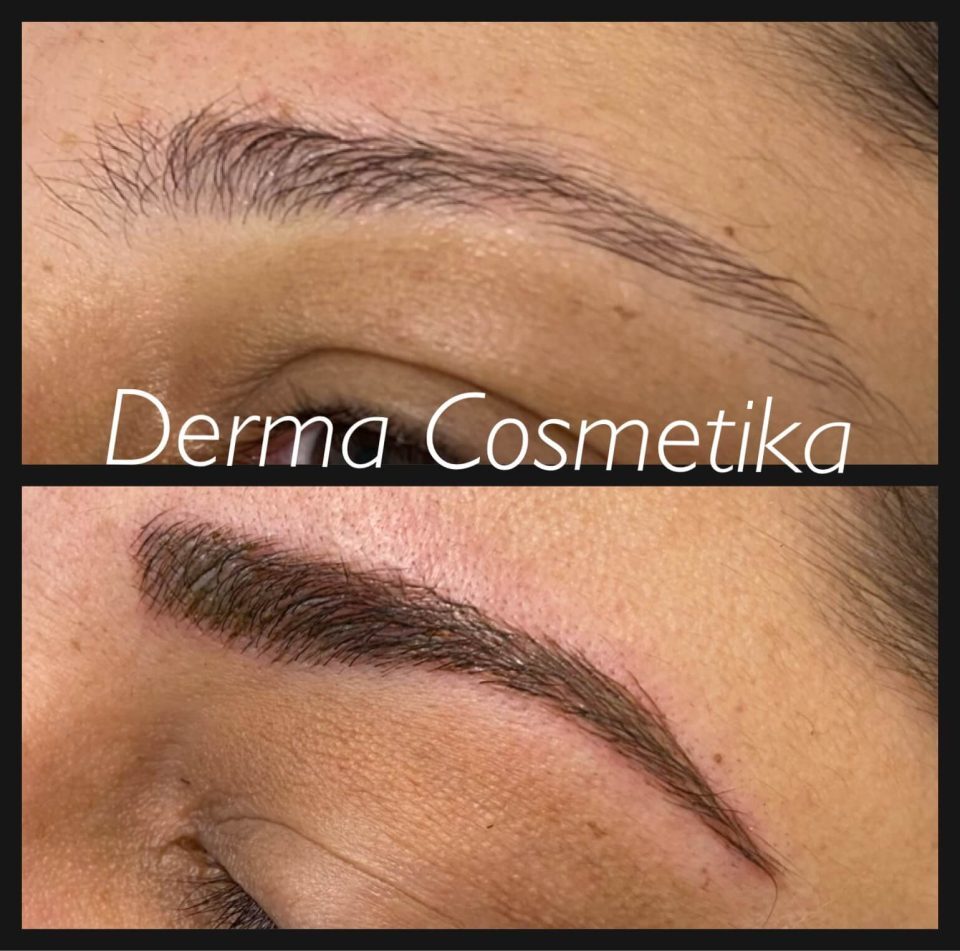 Cosmetic tattoo before after