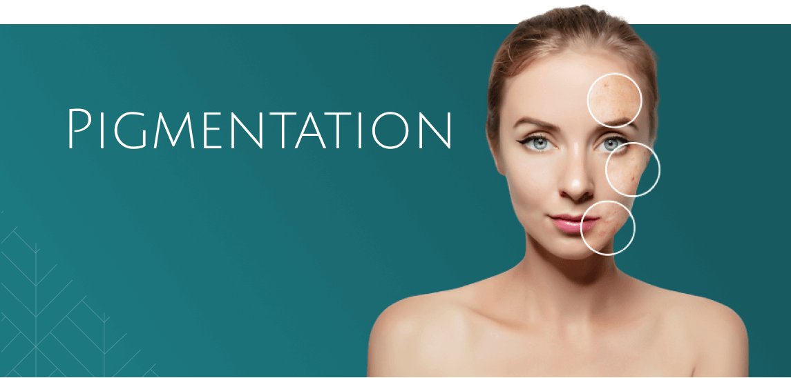 Pigmentation