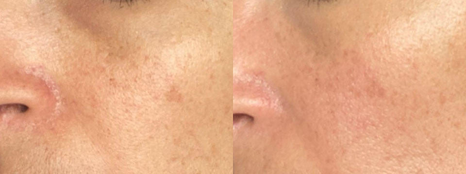 DC signature glow facial